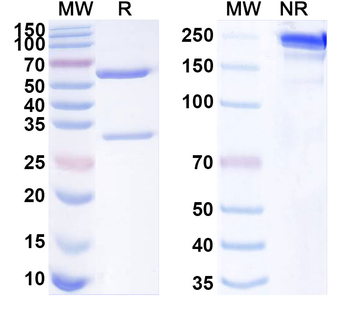 GARS1/Glycyl-tRNA synthetase Mouse Monoclonal Antibody