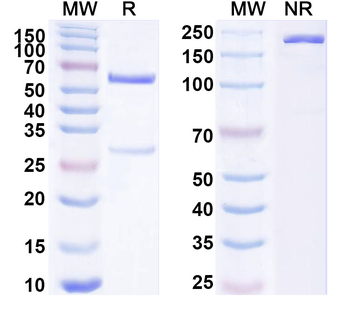 TOR1A/Torsin-1A/DQ2 Mouse Monoclonal Antibody