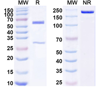 TGFBR2/TGFR-2 Mouse Monoclonal Antibody