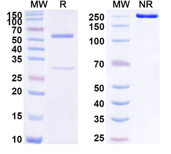 TTR/Prealbumin/Transthyretin Mouse Monoclonal Antibody
