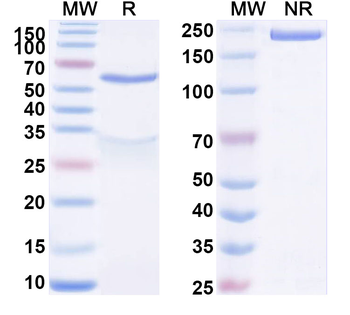 ACVR2B Mouse Recombinant Antibody
