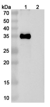 CTAG1A/NY-ESO-1/LAGE-2 Mouse Monoclonal Antibody