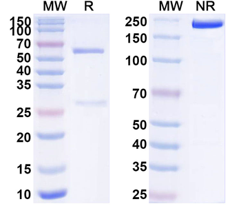 S100B Mouse Monoclonal Antibody
