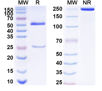 MMP3 Mouse Monoclonal Antibody