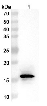 Vaccinia A27 Human Monoclonal Antibody