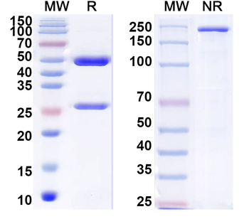 Neisseria meningitidis group B LPS/Lipopolysaccharide Mouse Monoclonal Antibody