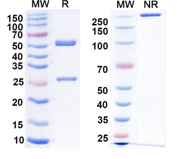 DENV-2 E-DII/Envelope Protein E Mouse Monoclonal Antibody