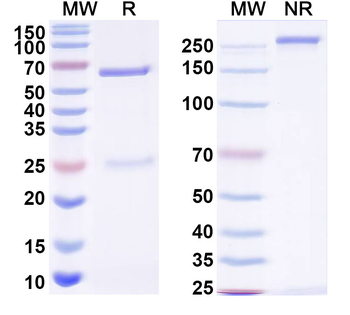HBV-A S/L-HBsAg/L glycoprotein Human Monoclonal Antibody