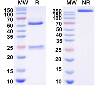 HBV-A S-HBsAg/SHB Human Monoclonal Antibody