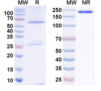 Haemophilus influenzae ompP1 Human Monoclonal Antibody