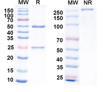 Pan HBV S/L-HBsAg/L glycoprotein Human Monoclonal Antibody