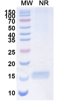 SARS-CoV-2 S Protein Camelus Monoclonal Antibody