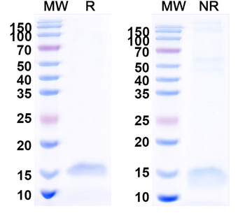 SARS-CoV-2 S Protein Camelus Monoclonal Antibody