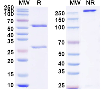 DENV-2 Envelope protein E/EDIII Human Monoclonal Antibody
