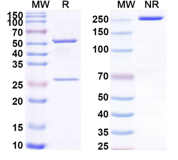 CH1/CH2/Allergen Fel d I-A/B Human Monoclonal Antibody