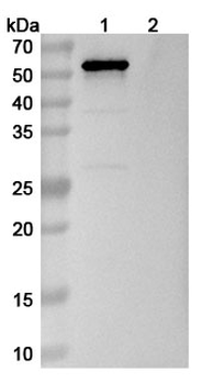 OPN/SPP1 Human Monoclonal Antibody