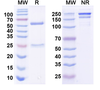 CXCL12/SDF-1 Human Monoclonal Antibody