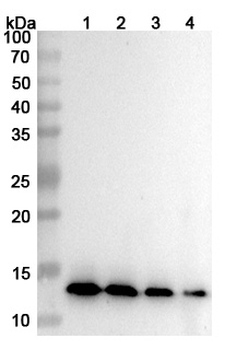 CXCL10/IP-10 Human Monoclonal Antibody