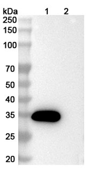 CCL11/Eotaxin Human Monoclonal Antibody