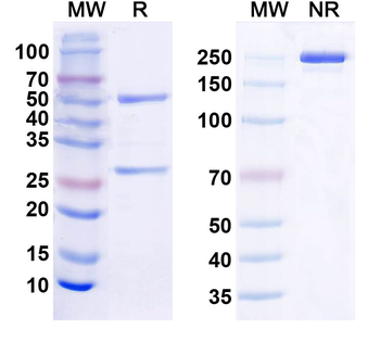 CCL2/MCP-1 Human Monoclonal Antibody