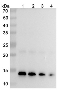 CCL2/MCP-1 Human Monoclonal Antibody