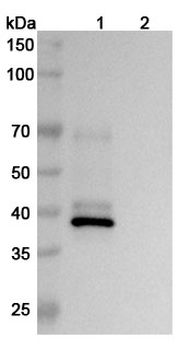 NGF/Beta-NGF Human Monoclonal Antibody