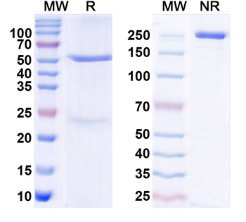 GDF15 Human Monoclonal Antibody