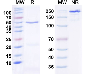 IL36RN/IL-1F5 Human Monoclonal Antibody