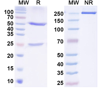 IL1B/IL1F2 Human Monoclonal Antibody