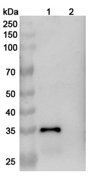 Dermatophagoides farinae DERF1/DERP1 Human Monoclonal Antibody