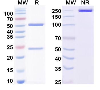 FMDV Capsid protein VP1 Human Monoclonal Antibody