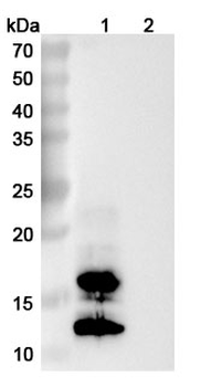 Vaccinia virus/VACV A27L Human Monoclonal Antibody