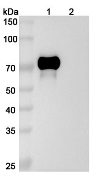 AFP/Alpha-fetoprotein Mouse Monoclonal Antibody