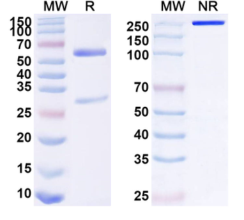 VAP-1/AOC3 Mouse Monoclonal Antibody