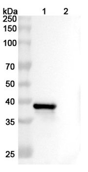 ARG2/Arginase II Mouse Monoclonal Antibody