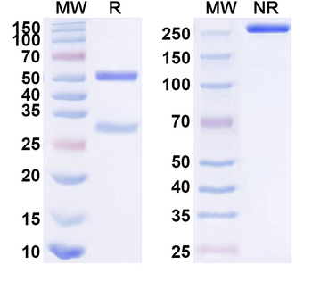 Gal-10/CLC Mouse Monoclonal Antibody