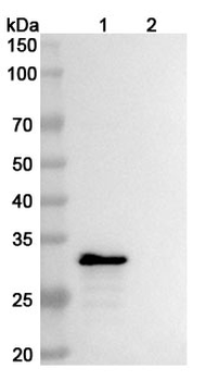 MMP14 Mouse Monoclonal Antibody