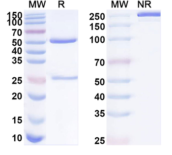 MMP9 Mouse Monoclonal Antibody