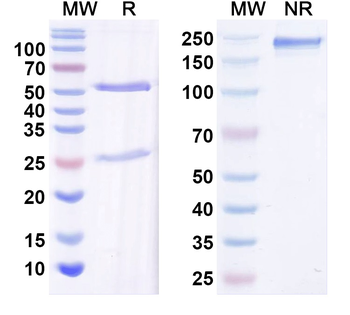Corynephage omega DT/Diphtheria toxin Mouse Monoclonal Antibody
