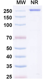 CHIKV Spike glycoprotein E2 Human Monoclonal Antibody
