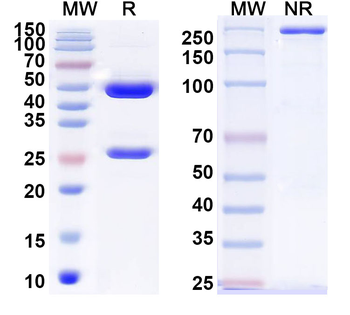 TSHR Mouse Monoclonal Antibody