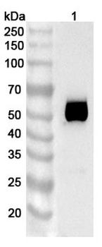 TSHR Mouse Monoclonal Antibody