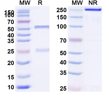 HLA-A2-peptide (KTWGQYWQV) Complex Mouse Monoclonal Antibody