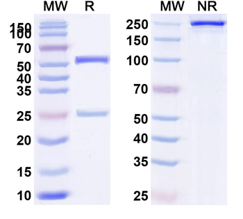HLA-A2-peptide (KTWGQYWQV) Complex Mouse Monoclonal Antibody