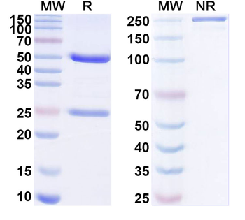 SARS-CoV-2 NP/Nucleoprotein Human Monoclonal Antibody