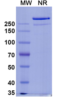 SARS-CoV-2 NTD Human Monoclonal Antibody