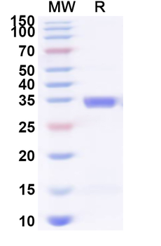 Recombinant Mouse TACSTD2/TROP2 Protein, N-His