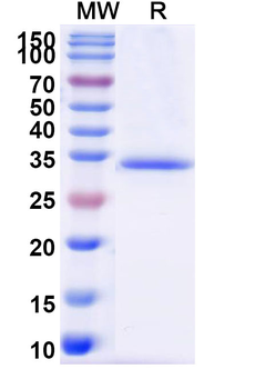 Recombinant SARS-CoV-2 NSP12/RdRp Protein, C-His