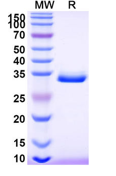 Recombinant Human CTSB Protein, N-His