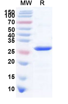 Recombinant Mouse CD74 Protein, N-His